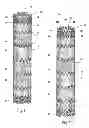 Fig. 02 - Systems and methods for attaching a prosthesis within a body lumen or hollow organ