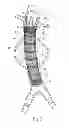 Fig. 03 - Systems and methods for attaching a prosthesis within a body lumen or hollow organ