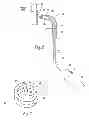 Fig. 06 - Systems and methods for attaching a prosthesis within a body lumen or hollow organ