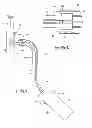 Fig. 10 - Systems and methods for attaching a prosthesis within a body lumen or hollow organ