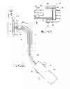 Fig. 11 - Systems and methods for attaching a prosthesis within a body lumen or hollow organ