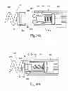 Fig. 15 - Systems and methods for attaching a prosthesis within a body lumen or hollow organ