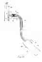 Fig. 16 - Systems and methods for attaching a prosthesis within a body lumen or hollow organ