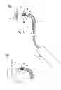 Fig. 17 - Systems and methods for attaching a prosthesis within a body lumen or hollow organ