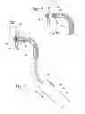 Fig. 20 - Systems and methods for attaching a prosthesis within a body lumen or hollow organ