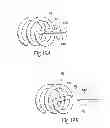 Fig. 23 - Systems and methods for attaching a prosthesis within a body lumen or hollow organ