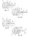 Fig. 26 - Systems and methods for attaching a prosthesis within a body lumen or hollow organ
