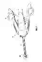 Fig. 02 - Surgical clip applier