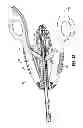 Fig. 08 - Surgical clip applier