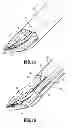 Fig. 10 - Surgical clip applier