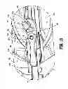 Fig. 12 - Surgical clip applier