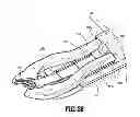 Fig. 17 - Surgical clip applier
