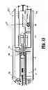 Fig. 20 - Surgical clip applier
