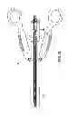 Fig. 21 - Surgical clip applier
