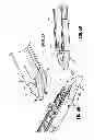 Fig. 30 - Surgical clip applier