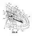Fig. 35 - Surgical clip applier
