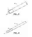 Fig. 04 - Suture trimmer