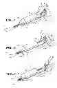 Fig. 05 - Suture trimmer