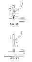 Fig. 09 - Suture trimmer
