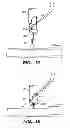 Fig. 11 - Suture trimmer