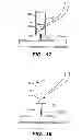 Fig. 12 - Suture trimmer