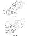Fig. 02 - Low profile medical device and related methods of use