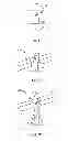 Fig. 04 - Suturing apparatus and method