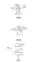 Fig. 05 - Suturing apparatus and method