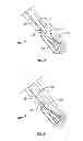 Fig. 16 - Suturing apparatus and method