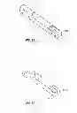 Fig. 21 - Suturing apparatus and method
