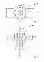 Fig. 09 - Fixation systems and methods