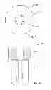 Fig. 17 - Fixation systems and methods