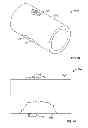 Fig. 21 - Fixation systems and methods