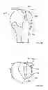 Fig. 29 - Fixation systems and methods
