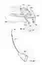 Fig. 33 - Fixation systems and methods