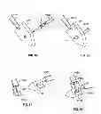 Fig. 42 - Fixation systems and methods