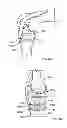 Fig. 43 - Fixation systems and methods