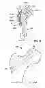 Fig. 44 - Fixation systems and methods