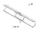 Fig. 49 - Fixation systems and methods