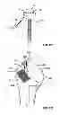 Fig. 58 - Fixation systems and methods