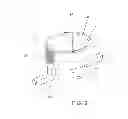 Fig. 04 - Method and apparatus for effecting a minimally invasive distal anastomosis for an aortic valve bypass