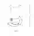 Fig. 07 - Method and apparatus for effecting a minimally invasive distal anastomosis for an aortic valve bypass