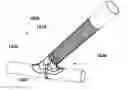 Fig. 01 - Vessel shaping devices and methods