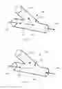 Fig. 06 - Vessel shaping devices and methods