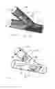 Fig. 07 - Vessel shaping devices and methods