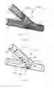 Fig. 08 - Vessel shaping devices and methods