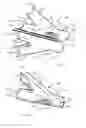 Fig. 09 - Vessel shaping devices and methods