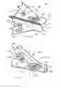 Fig. 10 - Vessel shaping devices and methods