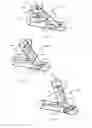 Fig. 11 - Vessel shaping devices and methods