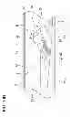 Fig. 14 - Eccentric pass-thru cutter